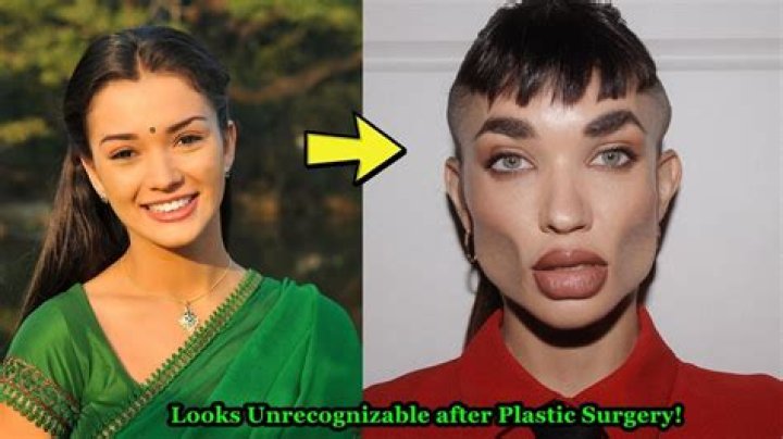 [BREAKING] Kristi Noem's Shocking Plastic Surgery Reveal