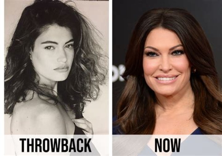 Definitive Guide To Kimberly Guilfoyle's Plastic Surgery Procedures