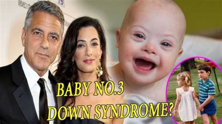 Does George Clooney's Son Have Down Syndrome? Important Facts To Know