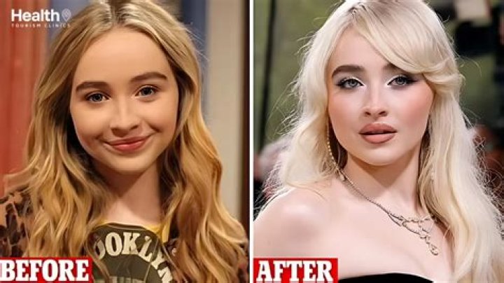 Get The Scoop On Sabrina Carpenter's Cosmetic Surgeries