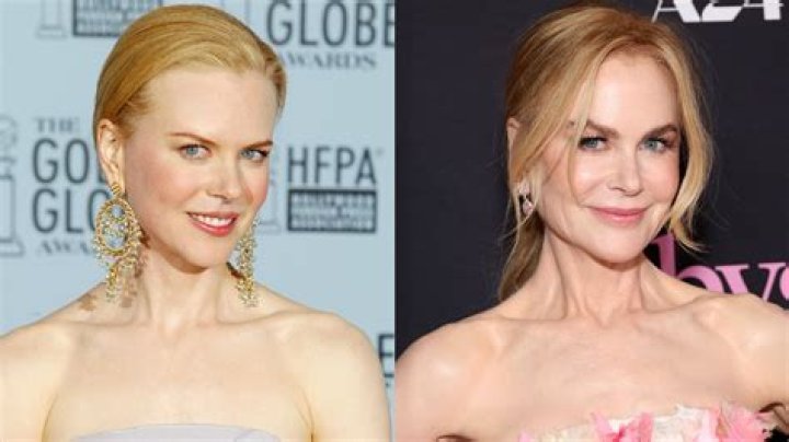 Nicole Kidman Plastic Surgery: A Comprehensive Guide To Her Procedures