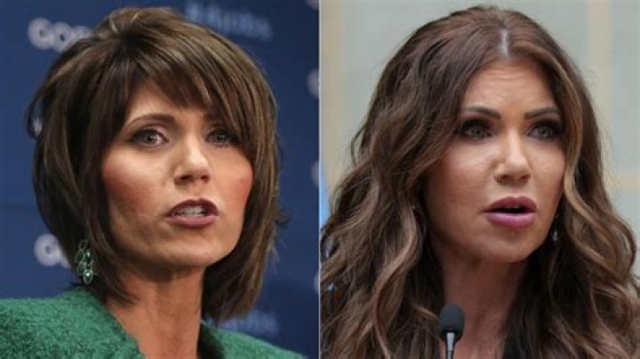 The Ultimate Guide To Kristi Noem's Plastic Surgery Journey