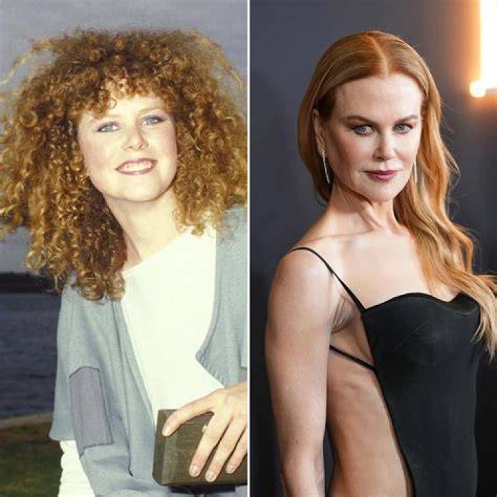 The Unrecognizable Transformation: Nicole Kidman's Plastic Surgery Journey