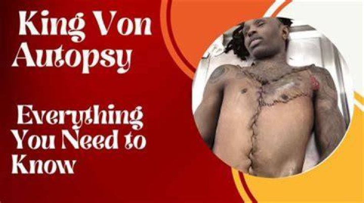 Understanding The Tragic Death Of King Von: A Comprehensive Analysis