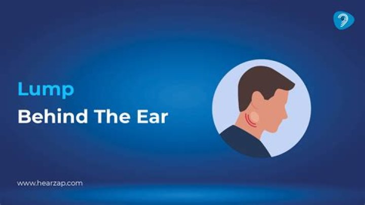 Unveiling The Mystery: Cillian Murphy's Lump Behind The Right Ear
