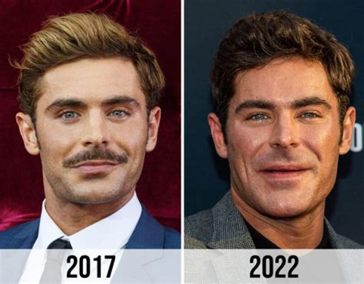 Unveiling The Truth Behind George Lopez's Facial Transformation