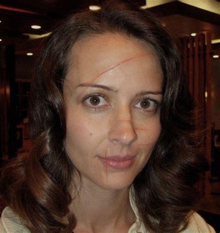Unveiling The Truth Behind Jessica Dube's Injury Face: Discoveries And Insights